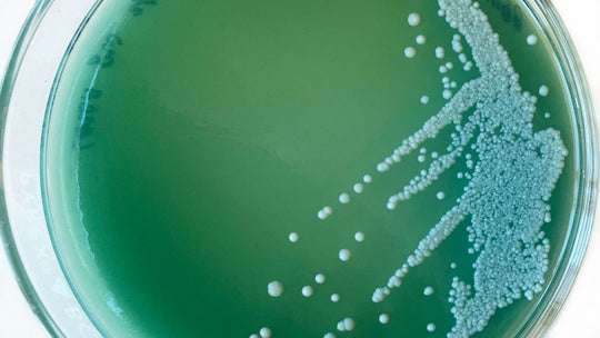 Petri dish with green-colored agar with yeast cells growing on the right side of the plate (streak plate)